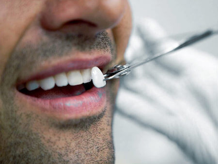 reduced-restaura-sorrisos-tratamentos-chamadaslentes-de-contato